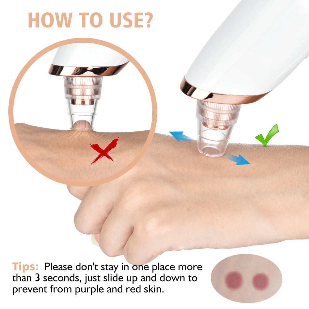 3 Suction Mode Blackhead Remover Face Cleansing Beauty Machine Dead Skin Remover Face Vacuum Blackhead Removal Skin Care Tool